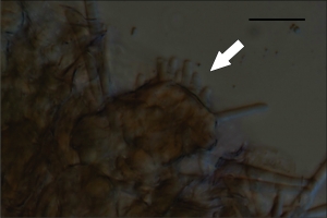 Conidióforos, escala indica 20µm