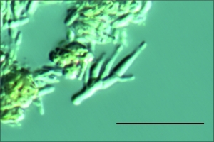 Conidióforo em destaque, escala indica 20µm