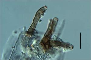 Conidióforos, escala indica 20µm