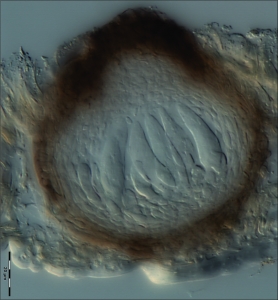 Pseudotécio, escala indica 20µm